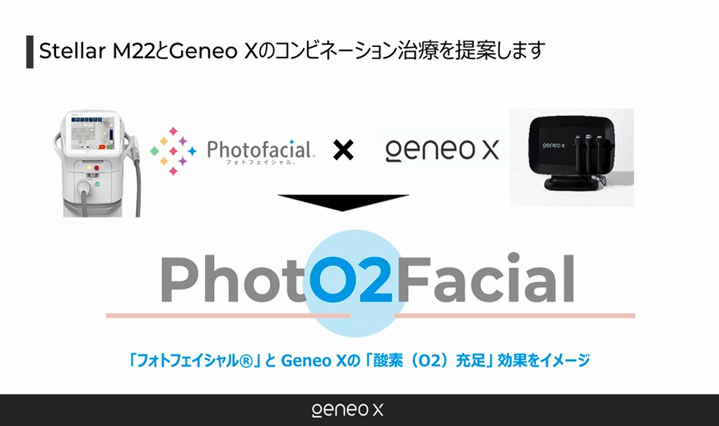 フォト2フェイシャルとは