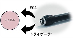 1.引き締め(タイトニング)